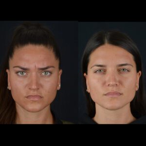 1-5-300x300