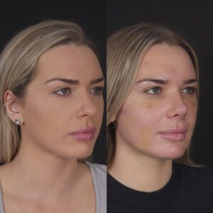 11-300x300