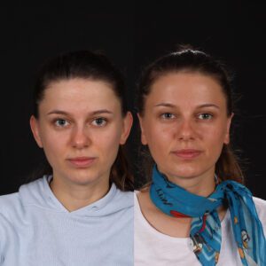 2-10-300x300