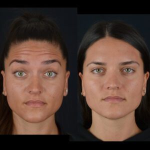 2-4-300x300