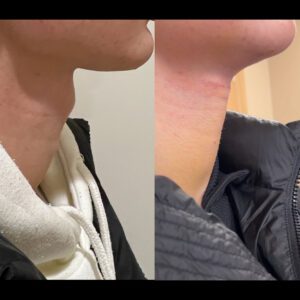 22-yas-1.-hafta-sonucu-300x300