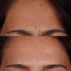 3-300x300
