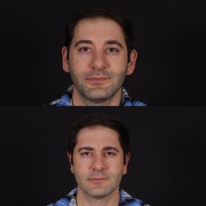 3-9-300x300