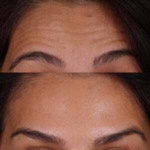 4-300x300