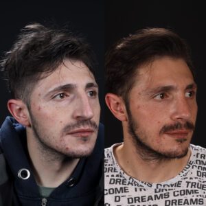 4-7-300x300