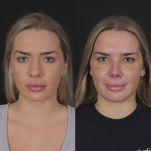 44-300x300