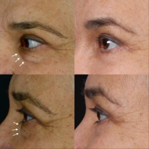 54-yas-6.-ay-sonucu-300x300