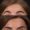 Botox-10-2-300x300