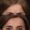 Botox-10-300x300