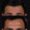 Botox-11-2-300x300