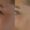 Botox-2-300x300
