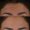 Botox-3-2-300x300