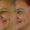 Botox-4-300x300