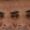 Botox-5-2-1-300x300