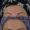 Botox-6-2-300x300