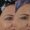 Botox-6-4-300x300