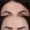 Botox-7-birlesmis-hali-1-300x300