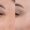 Botox-7-birlesmis-hali-3-1-300x300