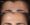 Botox-8-2-362x300