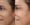 Botox-8-3-365x300