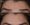 Botox-9-2-367x300