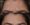 Botox-9-364x300