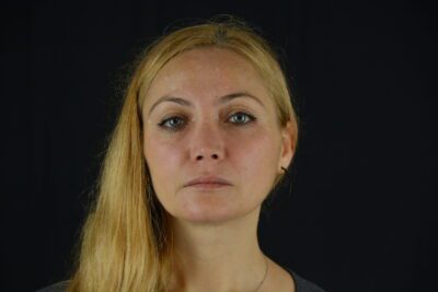 Dolgu-uygulamalari-Nazolabial-Dolgu-Rhinoplasti-scaled-1-400x267