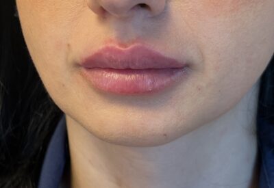 IMG_0442-400x275