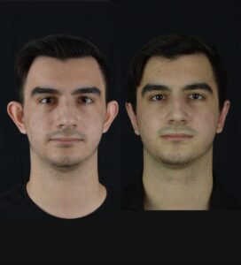 Kepce-kulak-1-272x300