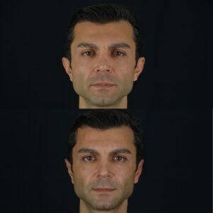 Kepce-kulak-2-3-300x300