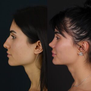 new1-1-300x300