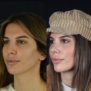 new1-3-300x300