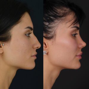 new2-1-300x300
