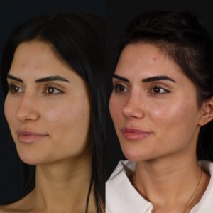 new3-1-300x300