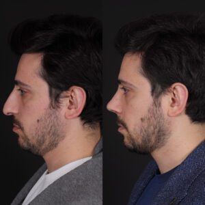 sinan-1-300x300