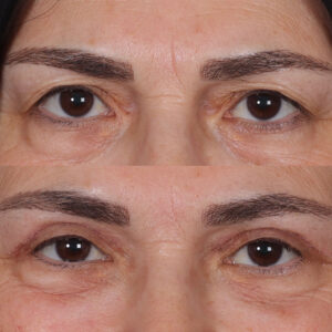 siteye-konulacak-300x300