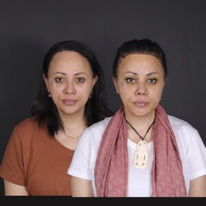 sonrasi-poz-kuculecek-300x300
