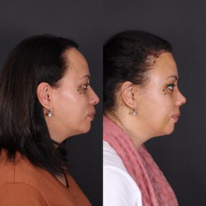 yeni-1-11-300x300