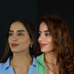 yeni-1-12-300x300