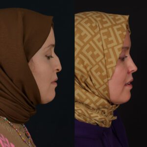 yeni-1-13-300x300