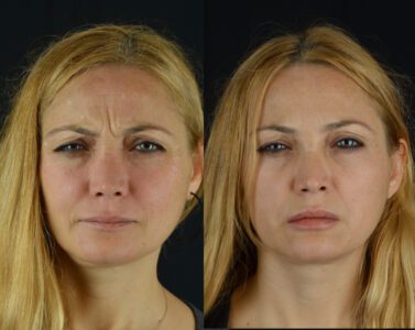 yeni-1-377x300