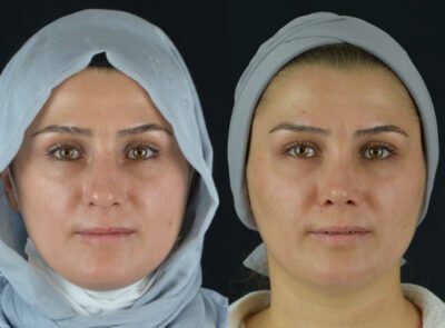 yeni-1-5-400x295