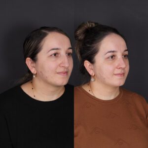 yeni-1-8-300x300