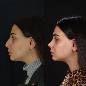 yeni-111-300x300