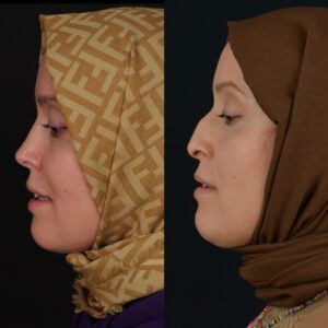 yeni-2-13-300x300