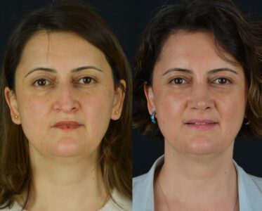 yeni-2-2-373x300