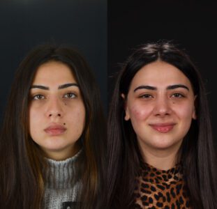 yeni-2-4-311x300