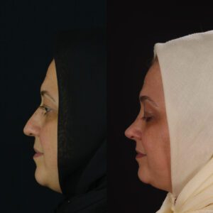 yeni-2-6-300x300