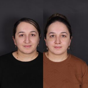 yeni-2-8-300x300