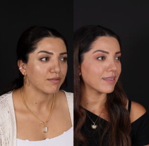 yeni-2-9-305x300